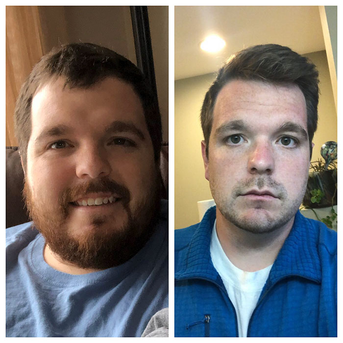 intermittent fasting