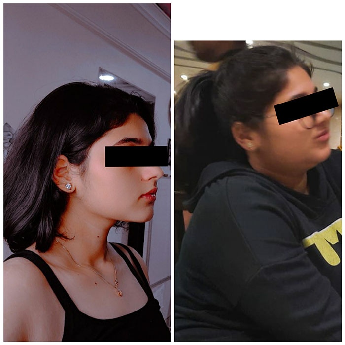 intermittent fasting